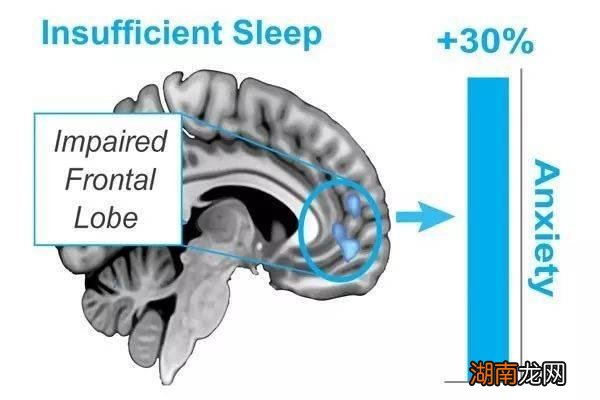 长期睡眠不足的大脑有多“脏”？